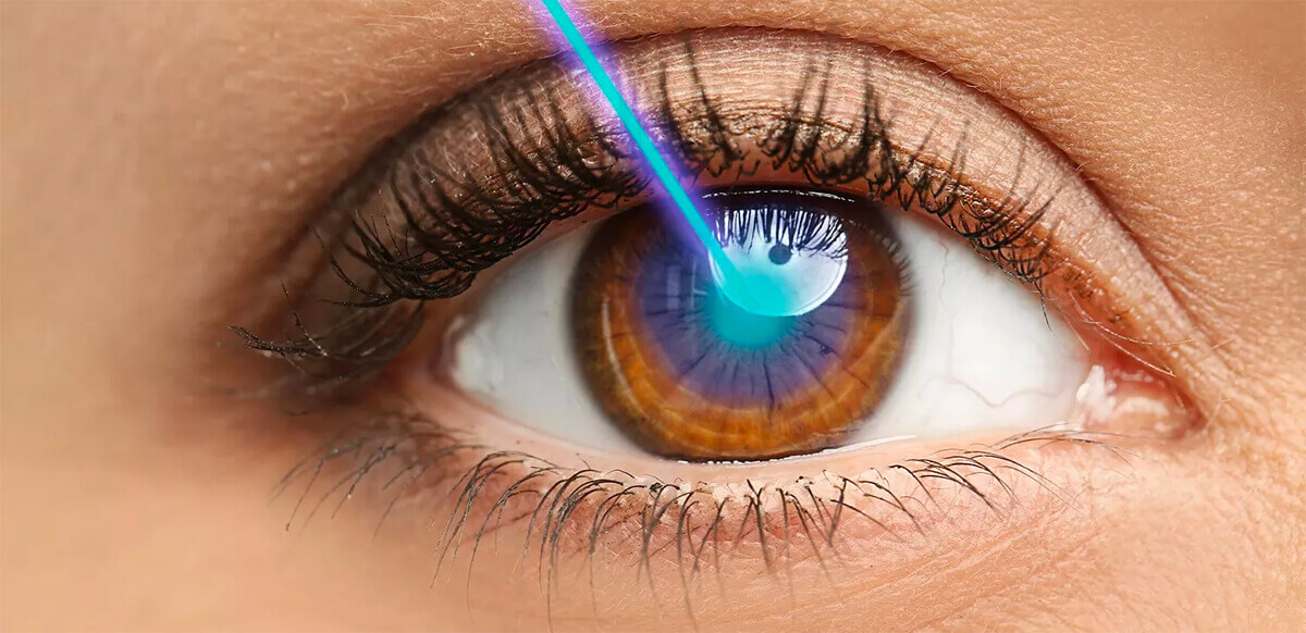 Laser-Augenchirurgie